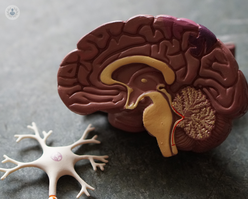 tumori-cerebrali-primitivi-o-gliomi-scopri-di-piu immagine dell'articolo