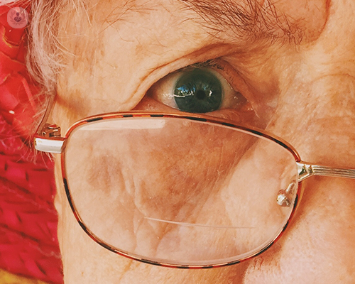 laserterapia-oculare-trattamenti-avanzati-per-la-salute-degli-occhi immagine dell'articolo