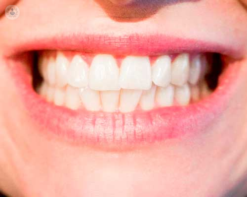 Protesi dentarie: di che cosa si tratta?