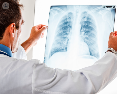 enfisema-polmonare-come-si-puo-curare immagine dell'articolo