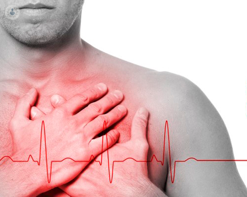 chi-e-a-rischio-di-aneurisma-dell-aorta immagine dell'articolo