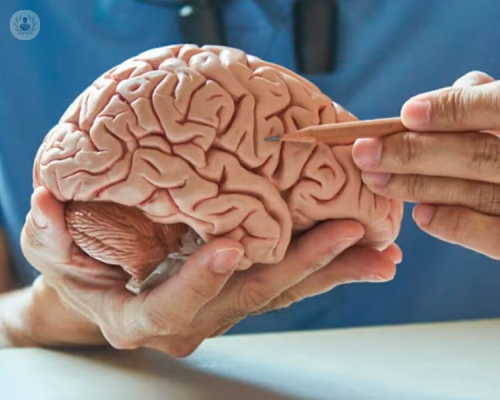 cosa-succede-a-chi-soffre-di-alzheimer immagine dell'articolo