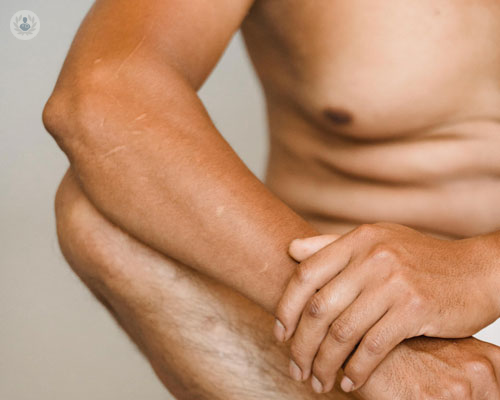 ginecomastia-sfida-clinica-e-soluzioni-terapeutiche immagine dell'articolo