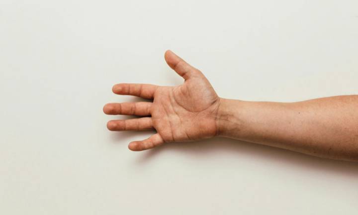 trattamento-della-fistola-artero-venosa-la-via-verso-il-benessere-vascolare immagine dell'articolo