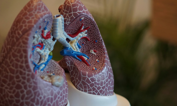 come-affrontare-l-enfisema-polmonare-dalla-diagnosi-alle-terapie immagine dell'articolo