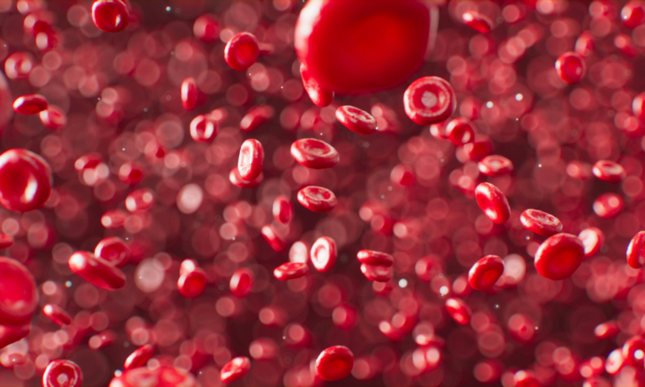 anemia-da-carenza-di-ferro-i-consigli-dell-ematologo immagine dell'articolo