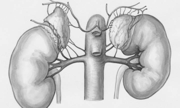 guida-ai-trattamenti-per-l-aneurisma-addominale-dalla-sorveglianza-alla-chirurgia immagine dell'articolo