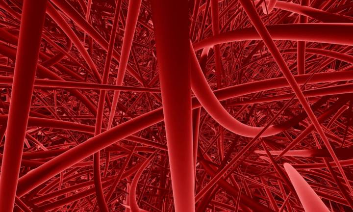 arteriopatia-ostruttiva-periferica-aop-quali-sono-le-cause immagine dell'articolo