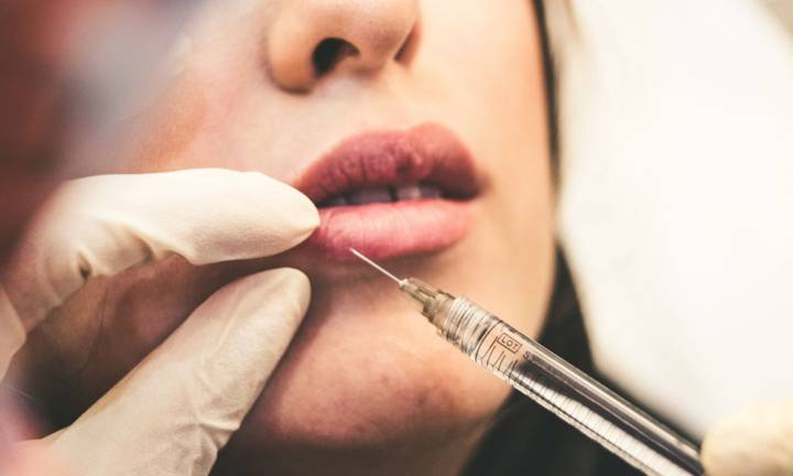 filler-labbra-come-funziona-e-quali-sono-i-suoi-benefici immagine dell'articolo