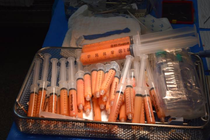 lipofilling-e-medicina-rigenerativa-con-cellule-staminali-del-grasso immagine dell'articolo