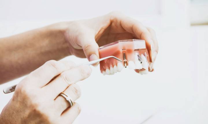 come-scegliere-e-mantenere-le-protesi-dentali-tipologie-e-durata immagine dell'articolo