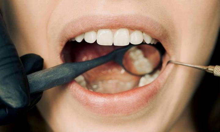 cancro-orale-riconoscere-sintomi-prevenzione immagine dell'articolo