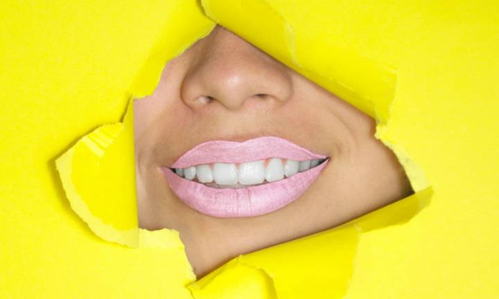 sorriso-splendente-esploriamo-i-vari-metodi-di-sbiancamento-dentale immagine dell'articolo