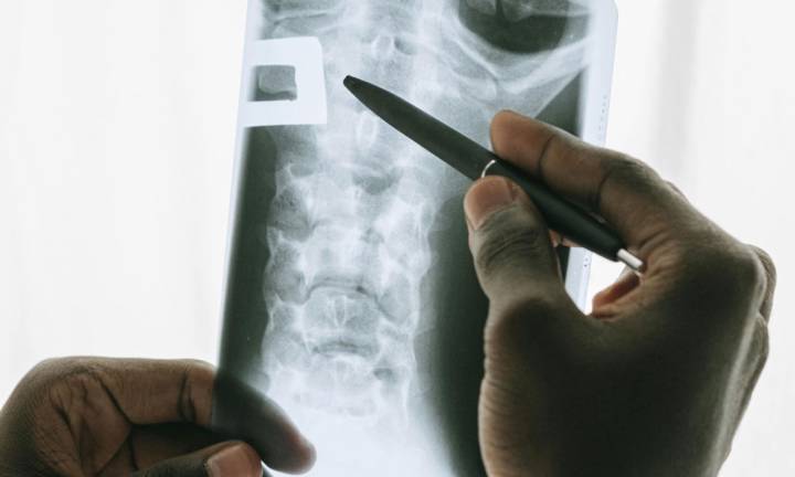 radiografia-torace-esame-indispensabile-per-salute-polmonare immagine dell'articolo