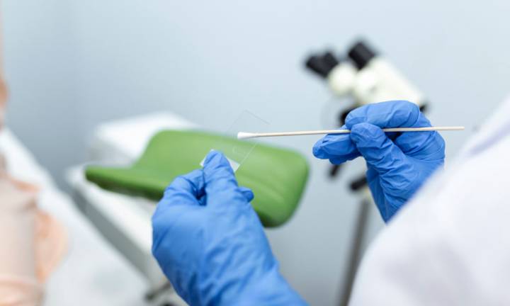 pap-test-esame-prevenzione-tumore-cervice-uterina immagine dell'articolo