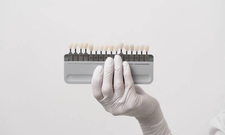 innesti-ossei-fondamenta-per-il-successo-degli-impianti-dentali immagine dell'articolo
