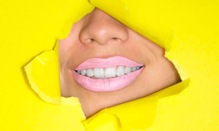 estetica-dentale-come-migliorare-il-sorriso immagine dell'articolo