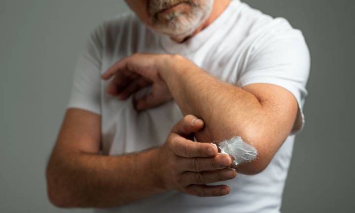 artrite-psoriasica-approcci-moderni-e-consigli-pratici-per-conviverci immagine dell'articolo