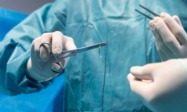 prevenzione-e-cura-del-sinus-pilonidalis-una-guida-per-il-benessere immagine dell'articolo