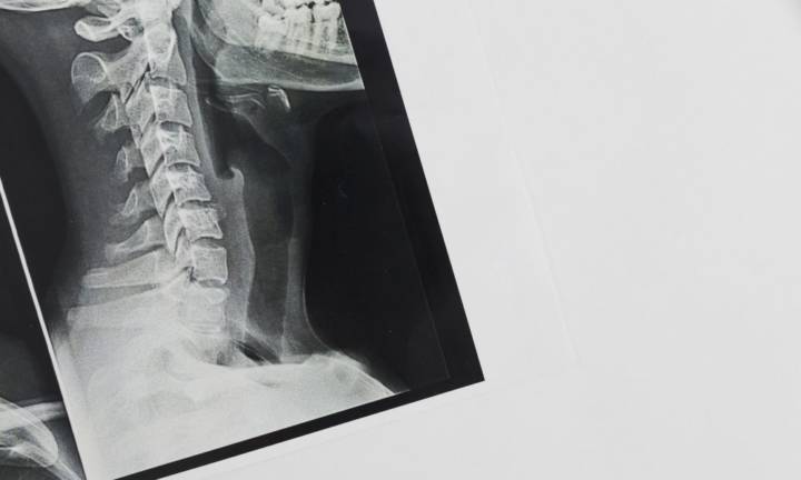 trattamenti-per-la-scoliosi-la-scienza-al-servizio-del-benessere-spinale immagine dell'articolo