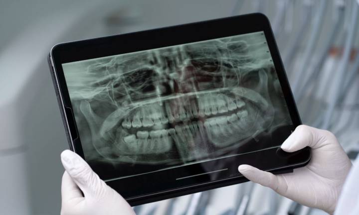 nuove-tecniche-di-imaging-una-visione-approfondita-della-salute-dentale- immagine dell'articolo