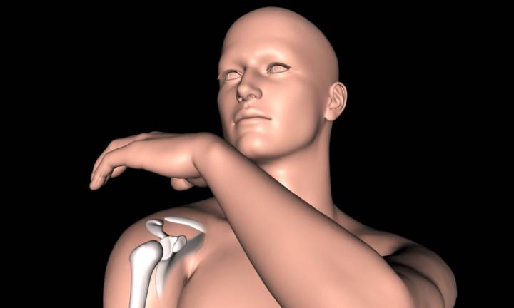 tutto-sull-artroplastica-della-spalla-il-futuro-della-chirurgia-ortopedica immagine dell'articolo