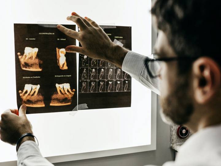 implantologia-denti-fissi-per-sempre immagine dell'articolo