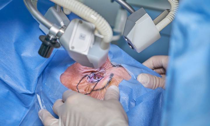 femtocataratta-innovazione-laser-per-cura-della-vista immagine dell'articolo