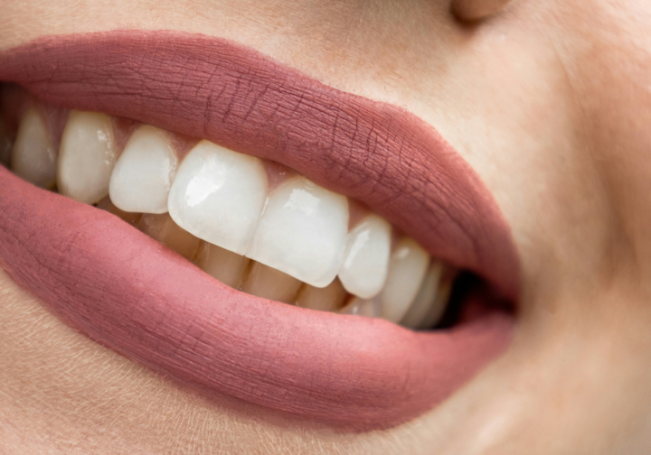 estetica-dentale-armonia-sorriso-approccio-integrato-filler-viso-labbra immagine dell'articolo