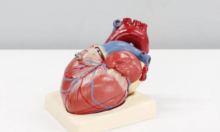 plastica-mitralica-riparazione-valvola-mitrale immagine dell'articolo