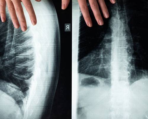 innovazione-chirurgia-vertebrale-navigazione-intraoperatoria-ricostruzione-3d immagine dell'articolo