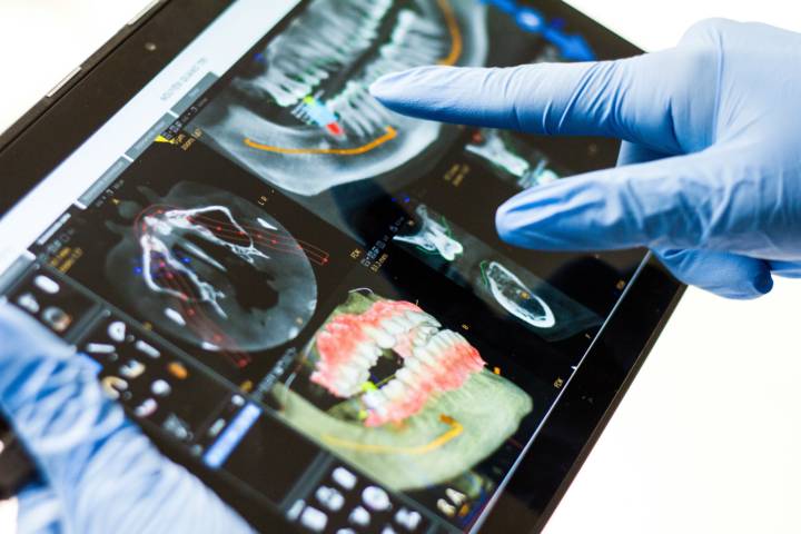 tecnologia-digitale-vs-analogica-in-odontoiatria immagine dell'articolo