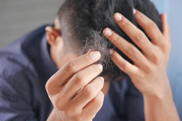 stress-e-salute-dei-capelli immagine dell'articolo