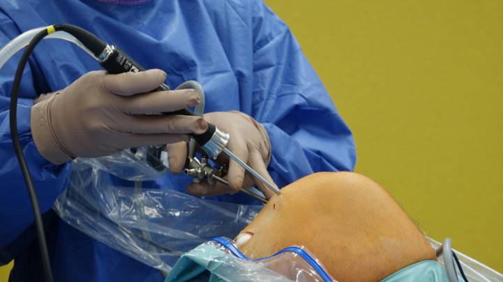 protesi-monocompartimentali-ginocchio-robot-vantaggi immagine dell'articolo