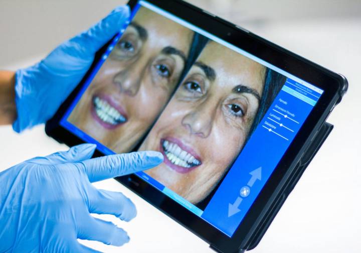 le-faccette-dentali-cosa-sono-e-quando-sceglierle immagine dell'articolo