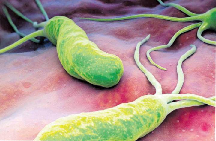 ricerca-helicobacter-pylori-diagnosi-e-terapia- immagine dell'articolo