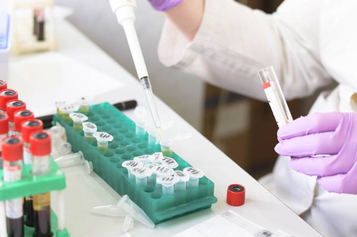 test-genetici-diagnosi-pancreatite-giovani immagine dell'articolo