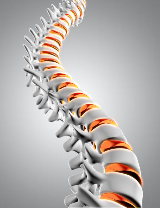 spondilolistesi-lombare-quando-consultare-specialista-colonna immagine dell'articolo