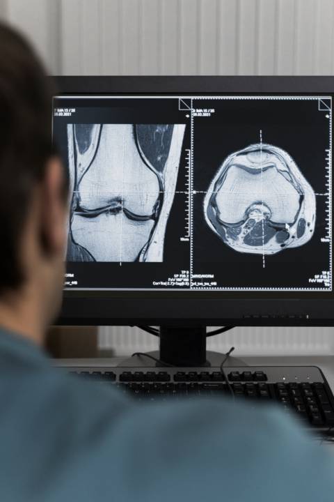 fratture-osteoporotiche-anziano-radiologia-diagnosi-trattamento immagine dell'articolo