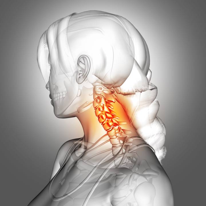 patologia-carotidea-segnali-rischi-trattamento immagine dell'articolo