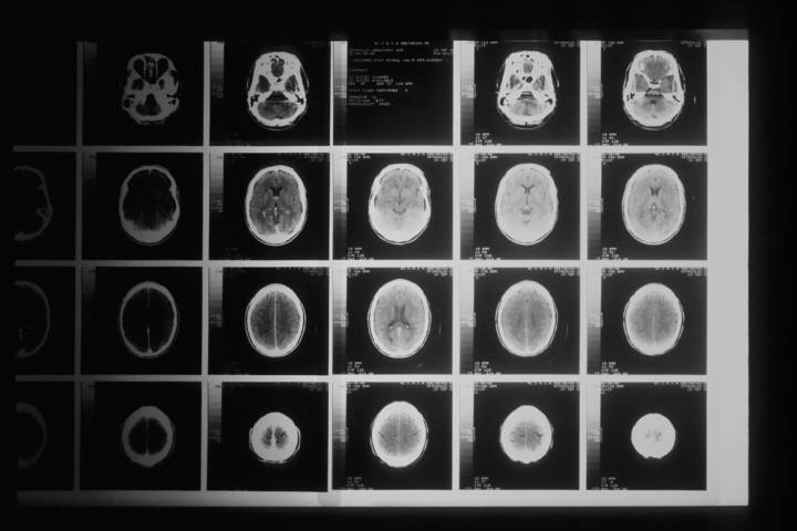 neuro-traumatologia-prevenzione-trattamento-lesioni-traumatiche immagine dell'articolo
