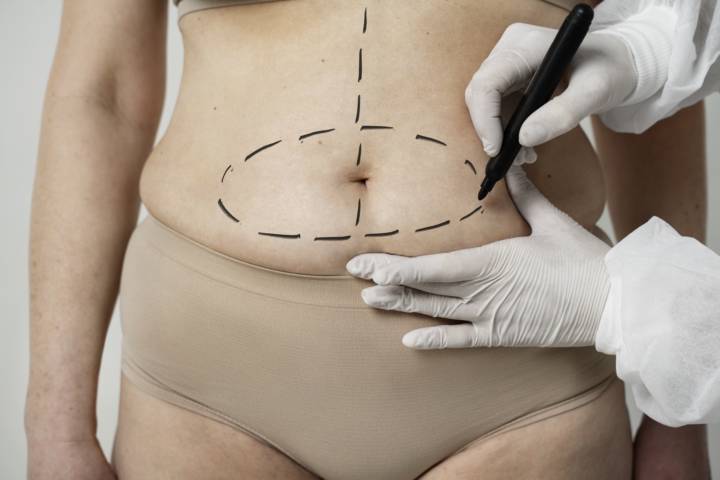 chirurgia-metabolica-sasi-oatb immagine dell'articolo