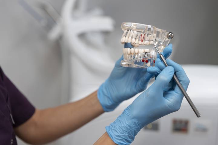 impianto-dentale-quanto-dura immagine dell'articolo
