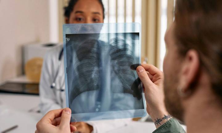 tumore-ai-polmoni-diagnosi-sintomi-e-trattamenti-innovativi immagine dell'articolo