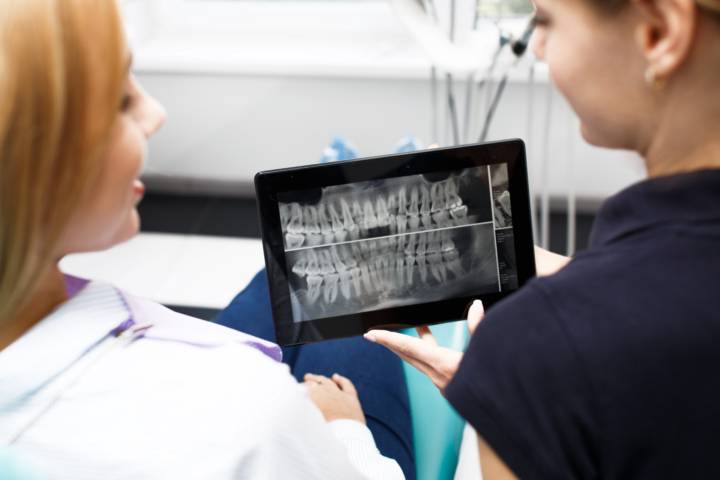 denti-fissi-instasmile-3d-implantologia-digitale immagine dell'articolo