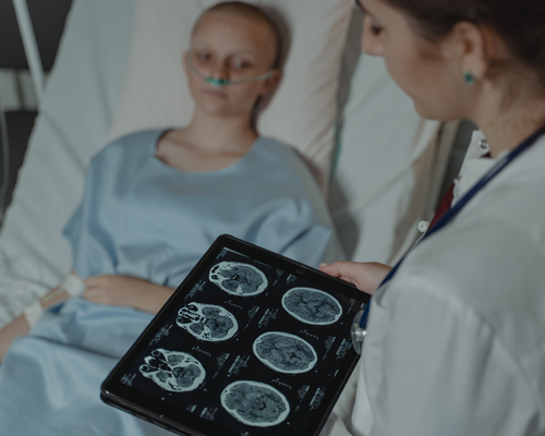 tumore-cervello-sintomi-diagnosi-terapie-nuove immagine dell'articolo