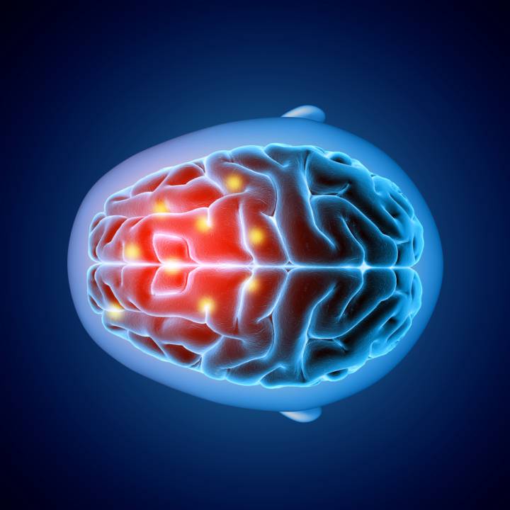 neurochirurgia-oncologica-gliolan-gliomi-alto-grado immagine dell'articolo