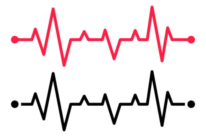 ritmo-cuore-aritmie-psicosomatica immagine dell'articolo