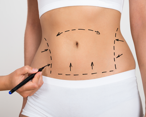 mommy-makeover-chirurgia-estetica-post-gravidanza immagine dell'articolo