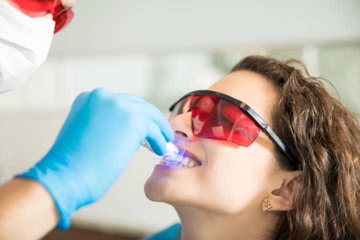 sbiancamento-dentale-laser-o-luce-led immagine dell'articolo